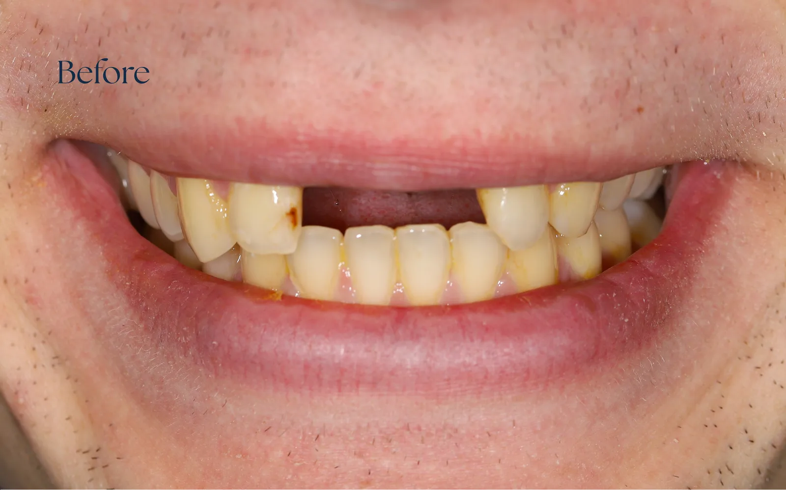 صورة ما قبل العلاج — case-001