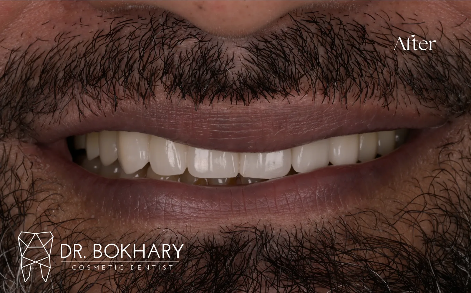 صورة ما بعد العلاج — case-002