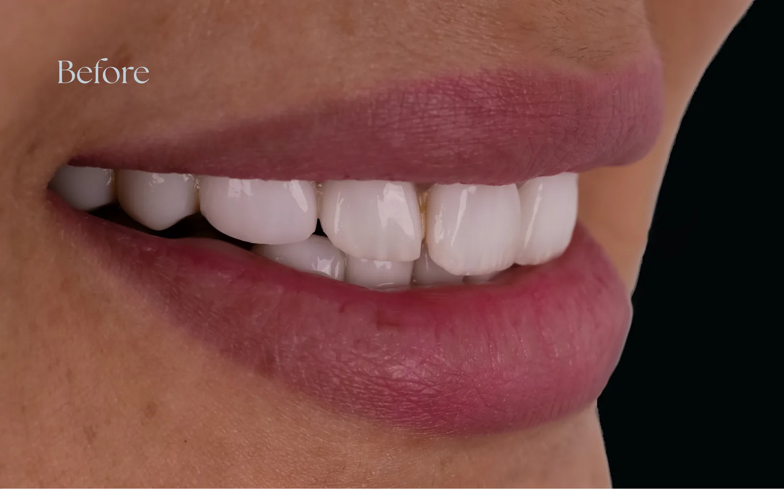 صورة ما قبل العلاج — case-003